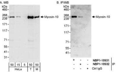 Western Blot: non-muscle heavy chain 10 Myosin Antibody [NBP1-18932] - Whole cell lysate from HeLa, 293T and mouse NIH3T3 cells. Myosin-10 was also immunoprecipitated by rabbit anti-Myosin-10 antibody NBP1-18931.