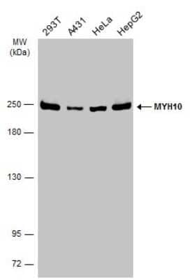 Western Blot: non-muscle heavy chain 10 Myosin Antibody [NBP3-13221] - Various whole cell extracts (30 ug) were separated by 5% SDS-PAGE, and the membrane was blotted with non-muscle heavy chain 10 Myosin antibody (NBP3-13221) diluted at 1:2000. The HRP-conjugated anti-rabbit IgG antibody (NBP2-19301) was used to detect the primary antibody.