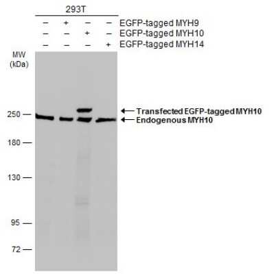 Western Blot: non-muscle heavy chain 10 Myosin Antibody [NBP3-13221] - Non-transfected (-) and transfected (+) non-muscle heavy chain 10 Myosin-transfected 293T (30 ug) were separated by 5% SDS-PAGE, and the membrane was blotted with non-muscle heavy chain 10 Myosin antibody (NBP3-13221) diluted at 1:5000. The HRP-conjugated anti-rabbit IgG antibody (NBP2-19301) was used to detect the primary antibody.