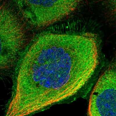 Immunocytochemistry/Immunofluorescence: noxin Antibody [NBP2-48685] - Staining of human cell line A-431 shows localization to plasma membrane & cytosol.