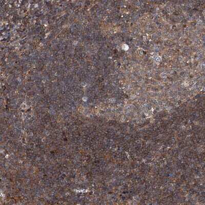 Immunohistochemistry-Paraffin: noxin Antibody [NBP2-48685] - Staining of human tonsil shows moderate cytoplasmic positivity in germinal center cells and non-germinal center cells.