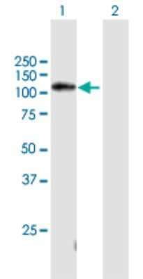 Western Blot: noxin Antibody [H00220042-B02P] - Analysis of C11orf82 expression in transfected 293T cell line by C11orf82 polyclonal antibody.  Lane 1: C11orf82 transfected lysate(111.50 KDa). Lane 2: Non-transfected lysate.