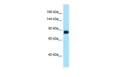 Western Blot: noxin Antibody [NBP2-87937] - Host: Rabbit. Target Name: C11orf82. Sample Type: HepG2 Whole Cell lysates. Antibody Dilution: 1.0ug/ml