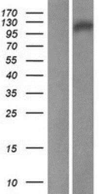 Western Blot noxin Overexpression Lysate