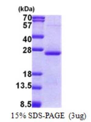 SDS-Page: orosomucoid 2 Protein [NBP2-23311]