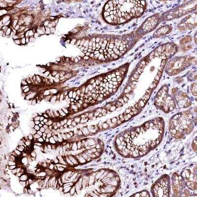 Immunohistochemistry ovochymase-1 Antibody - BSA Free