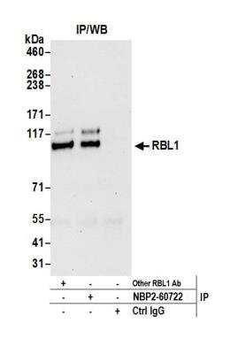 p107 Antibody [NBP2-60722] - Detection of human RBL1 by western blot of immunoprecipitates. Samples: Whole cell lysate (0.5 or 1.0 mg per IP reaction; 20% of IP loaded) from Jurkat cells prepared using NETN lysis buffer. Antibodies: Affinity purified rabbit anti-RBL1 antibody NBP2-60722 used for IP at 8 ul per reaction. RBL1 was also immunoprecipitated by another rabbit anti-RBL1 antibody. Detection: Chemiluminescence with an exposure time of 30 seconds.