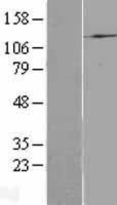 Western Blot: p110alpha/PIK3CA Overexpression Lysate (Adult Normal) [NBL1-14417] Left-Empty vector transfected control cell lysate (HEK293 cell lysate); Right -Over-expression Lysate for p110alpha/PIK3CA.