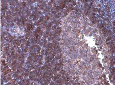 Immunohistochemistry-Paraffin: p114RhoGEF Antibody (1972) [NBP2-43546] -  Rat lymph node. ARHGEF18 stained by ARHGEF18 antibody [1972] diluted at 1:200.Antigen Retrieval: Citrate buffer, pH 6.0, 15 min