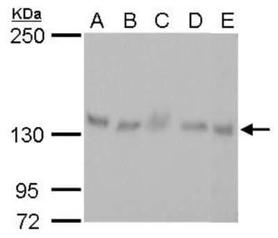 Western Blot: p114RhoGEF Antibody (1972) [NBP2-43546] - Analysis of A. 30 ug Neuro2A whole cell lysate/extract B. 30 ug GL261 whole cell lysate/extract C. 30 ug C8D30 whole cell lysate/extract D. 30 ug NIH-3T3 whole cell lysate/extract E. 30 ug C2C12 whole cell lysate/extract 5 % SDS-PAGE ARHGEF18 antibody [1972] dilution: 1:1000