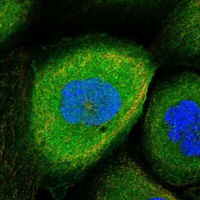 Immunocytochemistry/Immunofluorescence: p114RhoGEF Antibody [NBP1-92238] - Staining of human cell line A-431 shows localization to plasma membrane & cytosol. Antibody staining is shown in green.