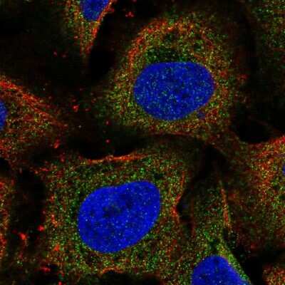 Immunocytochemistry/Immunofluorescence: p114RhoGEF Antibody [NBP2-57929] - Staining of human cell line U-2 OS shows localization to cytosol.