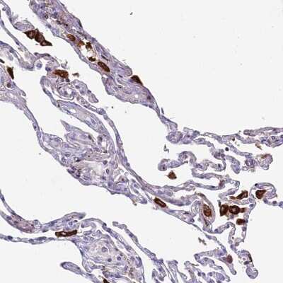 Immunohistochemistry-Paraffin: p114RhoGEF Antibody [NBP1-92238] - Staining of human lung shows strong cytoplasmic positivity in macrophages.