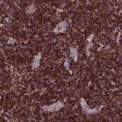 Immunohistochemistry-Paraffin: p114RhoGEF Antibody [NBP1-92238] - Staining of human lymph node shows strong cytoplasmic positivity in lymphoid cells.