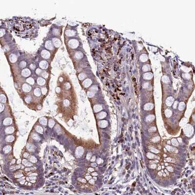 Immunohistochemistry-Paraffin: p114RhoGEF Antibody [NBP1-92238] - Staining of human small intestine shows strong cytoplasmic positivity in lymphoid cells.