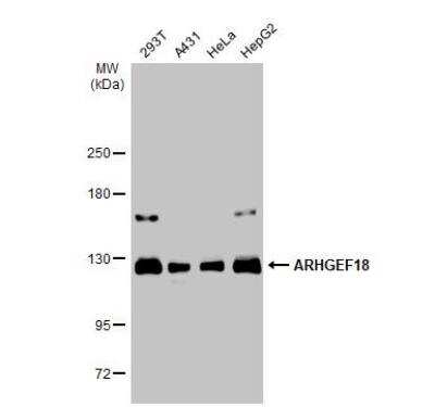 Western Blot: p114RhoGEF Antibody [NBP1-32816] - Various whole cell extracts (30 ug) were separated by 5% SDS-PAGE, and the membrane was blotted with ARHGEF18 antibody diluted at 1:1000. The HRP-conjugated anti-rabbit IgG antibody (NBP2-19301) was used to detect the primary antibody.