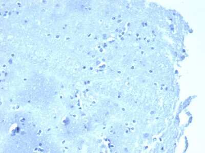 Immunohistochemistry-Paraffin: p120-catenin Antibody (4383R) - Azide and BSA Free [NBP3-08618] - Negative tissue control. IHC analysis of formalin-fixed, paraffin-embedded human brain stained with p120-catenin antibody (CTNND1/4383R) at 2ug/ml in PBS for 30min RT. HIER: Tris/EDTA, pH9.0, 45min. 2 : HRP-polymer, 30min. DAB, 5min.