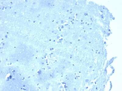 Immunohistochemistry-Paraffin: p120-catenin Antibody (4383R) [NBP3-07802] - Negative tissue control. IHC analysis of formalin-fixed, paraffin-embedded human brain stained with p120-catenin antibody (CTNND1/4383R) at 2ug/ml in PBS for 30min RT. HIER: Tris/EDTA, pH9.0, 45min. 2 : HRP-polymer, 30min. DAB, 5min.