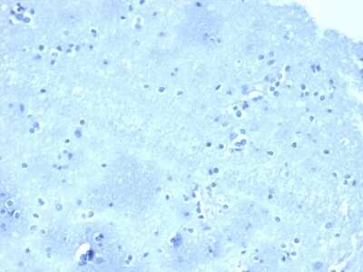 Immunohistochemistry-Paraffin: p120-catenin Antibody (CTNND1/4501) - Azide and BSA Free [NBP3-08614] - Negative tissue control. IHC analysis of formalin-fixed, paraffin-embedded human brain stained with p120-catenin antibody (CTNND1/4501) at 2ug/ml in PBS for 30min RT. HIER: Tris/EDTA, pH9.0, 45min. 2 : HRP-polymer, 30min. DAB, 5min.