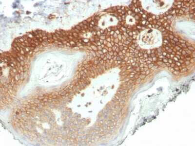 Immunohistochemistry-Paraffin: p120-catenin Antibody (CTNND1/4501) [NBP3-07801] - IHC analysis of formalin-fixed, paraffin-embedded human colon. p120-catenin antibody (CTNND1/4501) at 2ug/ml in PBS for 30min RT. HIER: Tris/EDTA, pH9.0, 45min. 2 : HRP-polymer, 30min. DAB, 5min.