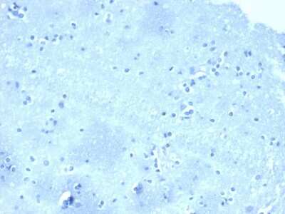 Immunohistochemistry-Paraffin: p120-catenin Antibody (CTNND1/4501) [NBP3-07801] - Negative tissue control. IHC analysis of formalin-fixed, paraffin-embedded human brain stained with p120-catenin antibody (CTNND1/4501) at 2ug/ml in PBS for 30min RT. HIER: Tris/EDTA, pH9.0, 45min. 2 : HRP-polymer, 30min. DAB, 5min.