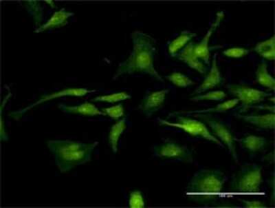Immunocytochemistry/Immunofluorescence: p120-catenin Antibody [H00001500-D01P] - Analysis of antibody to CTNND1 on HeLa cell. Antibody concentration 30 ug/ml.