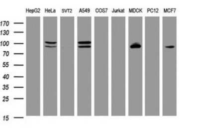 Western Blot: p120-catenin Antibody (OTI2E8) - Azide and BSA Free [NBP2-73179] - Analysis of extracts (35ug) from 9 different cell lines by using CTNND1 monoclonal antibody (HepG2: human; HeLa: human; SVT2: mouse; A549: human; COS7: monkey; Jurkat: human; MDCK: canine; PC12: rat; MCF7: human). Dilution: 1:2000