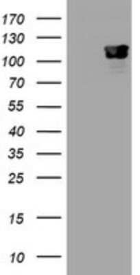 Western Blot: p120-catenin Antibody (OTI2E8) - Azide and BSA Free [NBP2-73179] - Analysis of HEK293T cells were transfected with the pCMV6-ENTRY control (Left lane) or pCMV6-ENTRY p120-catenin.