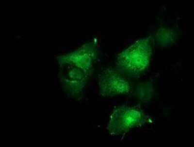 Immunocytochemistry/Immunofluorescence: p130Cas/BCAR1 Antibody (OTI1A9) - Azide and BSA Free [NBP2-73181] - Staining of COS7 cells transiently transfected by pCMV6-ENTRY BCAR1.