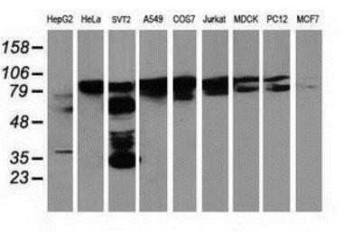 Western Blot: p130Cas/BCAR1 Antibody (OTI1A9) - Azide and BSA Free [NBP2-73181] - Analysis of extracts (35ug) from 9 different cell lines by using anti-BCAR1 monoclonal antibody.