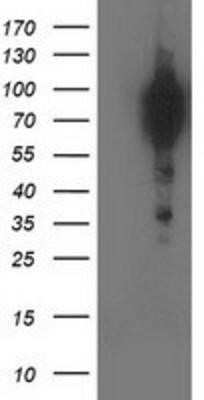 Western Blot: p130Cas/BCAR1 Antibody (OTI1A9) - Azide and BSA Free [NBP2-73181] - HEK293T cells were transfected with the pCMV6-ENTRY control (Left lane) or pCMV6-ENTRY BCAR1 (Right lane) cDNA for 48 hrs and lysed. Equivalent amounts of cell lysates (5 ug per lane) were separated by SDS-PAGE and immunoblotted with anti-BCAR1.