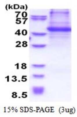 SDS-Page: p130Cas/BCAR1 Recombinant Protein [NBP2-51554] - 15% SDS Page (3 ug)