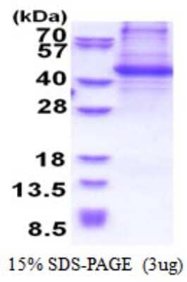 SDS-PAGE Recombinant Human p130Cas/BCAR1 His Protein