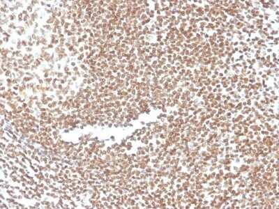 Immunohistochemistry-Paraffin: p16INK4a/CDKN2A Antibody (CDKN2A/3830) - Azide and BSA Free [NBP3-08234] - Formalin-fixed, paraffin-embedded human colon stained with p16INK4a/CDKN2A Mouse Monoclonal Antibody (CDKN2A/3830).