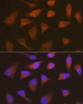 Immunocytochemistry/Immunofluorescence: p18INK4c/CDKN2C Antibody (1Q10Q4) [NBP3-16695] - Immunofluorescence analysis of HeLa cells using p18INK4c/CDKN2C Rabbit mAb (NBP3-16695) at dilution of 1:100 (40x lens). Blue: DAPI for nuclear staining.