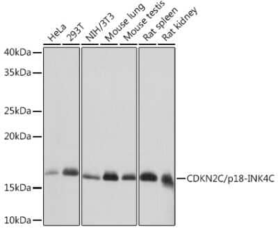 Western Blot: p18INK4c/CDKN2C Antibody (1Q10Q4) [NBP3-16695] - Western blot analysis of extracts of various cell lines, using p18INK4c/CDKN2C Rabbit mAb (NBP3-16695) at 1:1000 dilution. Secondary antibody: HRP Goat Anti-Rabbit IgG (H+L) at 1:10000 dilution. Lysates/proteins: 25ug per lane. Blocking buffer: 3% nonfat dry milk in TBST. Detection: ECL Basic Kit. Exposure time: 1s.