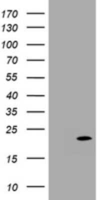 Western Blot: p18INK4c/CDKN2C Antibody (2E1) [NBP2-46229] - Analysis of HEK293T cells were transfected with the pCMV6-ENTRY control (Left lane) or pCMV6-ENTRY CDKN2C .