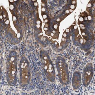 Immunohistochemistry-Paraffin: p18INK4c/CDKN2C Antibody [NBP1-87687] - Staining of human small intestine shows strong cytoplasmic positivity in glandular cells.