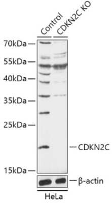 Knockout Validated: p18INK4c/CDKN2C Antibody [NBP3-03298] - Analysis of extracts from normal (control) and CDKN2C/p18-INK4C knockout (KO) HeLa cells, using p18INK4c/CDKN2C antibody at 1:1000 dilution. Secondary antibody: HRP Goat Anti-Rabbit IgG (H+L) at 1:10000 dilution. Lysates/proteins: 25ug per lane. Blocking Buffer: 3% nonfat dry milk in TBST.