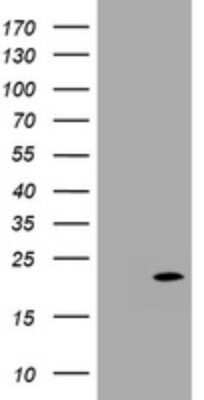Western Blot: p18INK4c/CDKN2C Antibody (OTI2E1) - Azide and BSA Free [NBP2-73185] - Analysis of HEK293T cells were transfected with the pCMV6-ENTRY control (Left lane) or pCMV6-ENTRY CDKN2C .