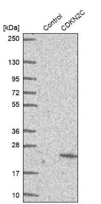 Western Blot: p18INK4c/CDKN2C Antibody [NBP1-87687] - Analysis in control (vector only transfected HEK293T lysate) and CDKN2C over-expression lysate (Co-expressed with a C-terminal myc-DDK tag (3.1 kDa) in mammalian HEK293T cells).