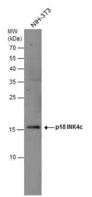 Western Blot: p18INK4c/CDKN2C Antibody [NBP3-12954] - Whole cell extract (30 ug) was separated by 15% SDS-PAGE, and the membrane was blotted with p18INK4c/CDKN2C antibody (NBP3-12954) diluted at 1:500.