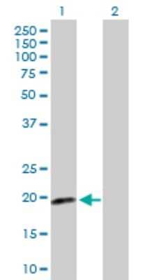 Western Blot: p19 INK4d Antibody [H00001032-D01P] - Analysis of CDKN2D expression in transfected 293T cell line by CDKN2D polyclonal antibody.Lane 1: CDKN2D transfected lysate(17.70 KDa).Lane 2: Non-transfected lysate.