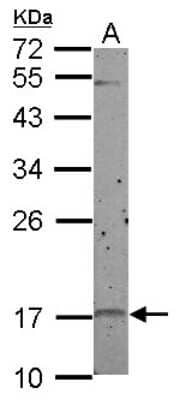 Western Blot: p19 INK4d Antibody [NBP2-19651] - Sample (50 ug of whole cell lysate) A: Rat bone marrow, 12% SDS PAGE gel, diluted at 1:500.