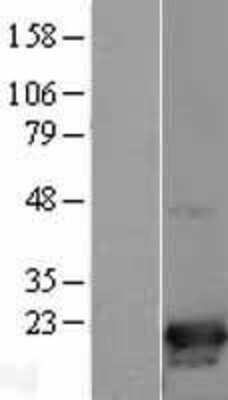 Western Blot: p19 INK4d Overexpression Lysate (Adult Normal) [NBL1-09056] Left-Empty vector transfected control cell lysate (HEK293 cell lysate); Right -Over-expression Lysate for p19 INK4d.