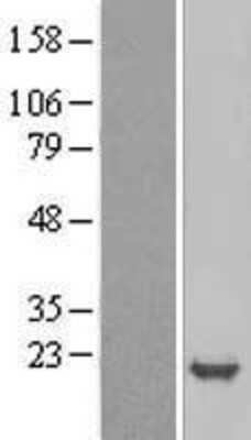 Western Blot: p19 INK4d Overexpression Lysate (Adult Normal) [NBL1-09057] Left-Empty vector transfected control cell lysate (HEK293 cell lysate); Right -Over-expression Lysate for p19 INK4d.