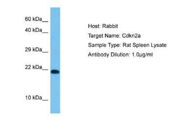 Western Blot: p19ARF/CDKN2A Antibody [NBP2-86741] - Host: Rabbit. Target Name: CDKN2A. Sample Tissue: Rat Spleen lysates. Antibody Dilution: 1ug/ml