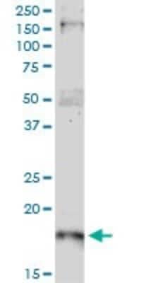 Western Blot: p21/CIP1/CDKN1A Antibody (2F1) [H00001026-M02] - CDKN1A monoclonal antibody (M02), clone 2F1. Analysis of CDKN1A expression in human liver.