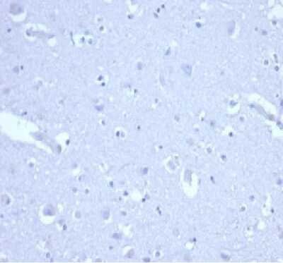 Immunohistochemistry-Paraffin: p21/CIP1/CDKN1A Antibody (CIP1/4377R) - Azide and BSA Free [NBP3-08961] - IHC analysis of formalin-fixed, paraffin-embedded human brain. Negative tissue control using p21/CIP1/CDKN1A antibody (CIP1/4377R) at 2ug/ml in PBS for 30min RT. HIER: Tris/EDTA, pH9.0, 45min. 2 : HRP-polymer, 30min. DAB, 5min.