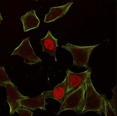 Immunocytochemistry/Immunofluorescence: p21/CIP1/CDKN1A Antibody (CIP1/823) - Azide and BSA Free [NBP2-47783] - Analysis of HeLa cells labeling p21 with p21/CIP1/CDKN1A Antibody (CIP1/823) followed by Goat anti-Mouse IgG-CF555 (Red). Membrane stained with Phalloidin 488 (Green).